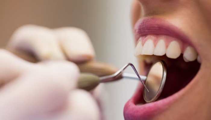 Why Tooth Spa Services Are Becoming the New Self-Care Ritual for Oral Wellness ?