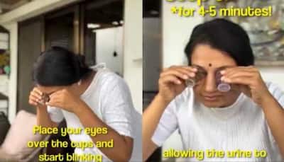 Terrifying Trend: Doctor Explains Why Urine In Eyes Is EXTREMELY Dangerous After Viral Video | WATCH