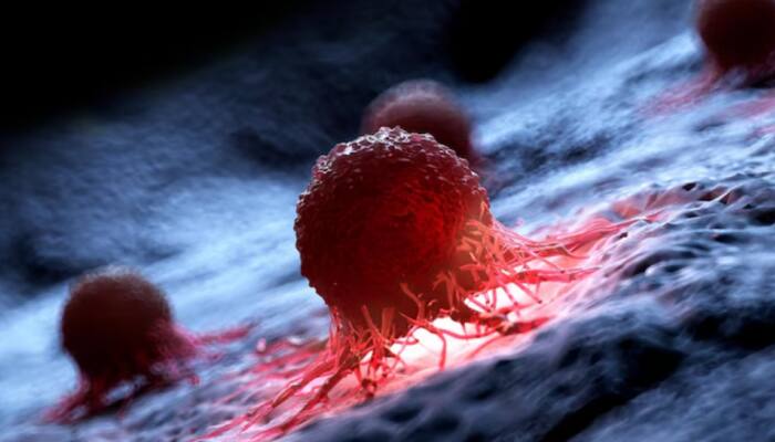 What Makes AML So Dangerous? Understanding One Of The Fastest-Growing And Hardest-To-Treat Blood Cancers