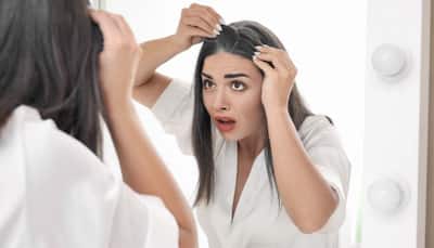 Say Goodbye To Premature Grey Hair With These 9 Natural And Easy Home Remedies