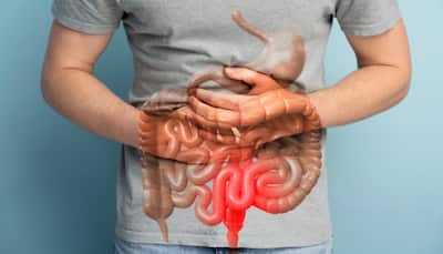 10 Natural Prebiotic Foods That Improve Gut Health, Digestion, And Overall Wellness