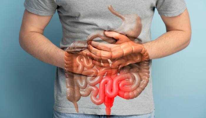 10 Natural Prebiotic Foods That Improve Gut Health, Digestion, And Overall Wellness