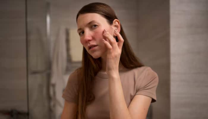 Is Your Diet Destroying Your Skin? 5 Common Foods That May Be To Blame