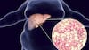 Liver Health