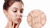 Is AC Drying Out Your Skin? Here’s How To Save Your Skin