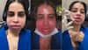 VIRAL VIDEO: Uorfi Javed REMOVED Lip Filler After 9 Years, Reveals SHOCKING Reason – WATCH