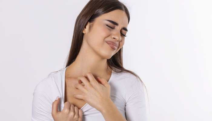Wearing Tight Clothes In Monsoon Behind Your Body Acne? Find Out Most-Affected Body Parts &amp; How To Deal With Breakouts