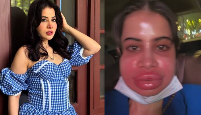 VIRAL VIDEO: Uorfi Javed Flaunts Her 'Filler-Free Face' After Massive Trolling – WATCH