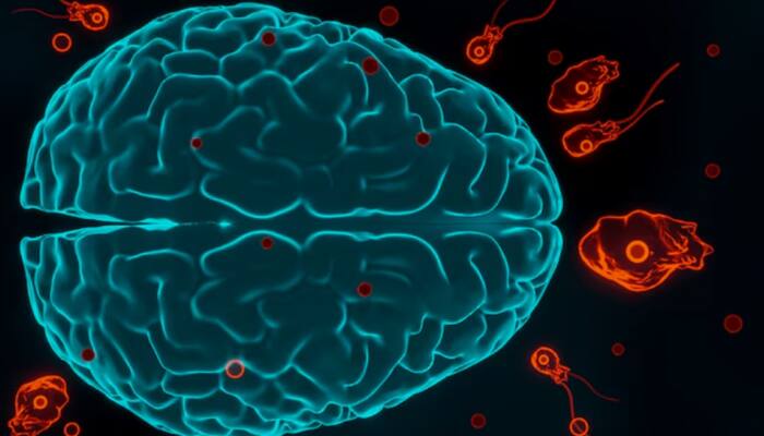 Child Dies After Brain-Eating Amoeba Attack - Know Early Signs Before It’s Too Late