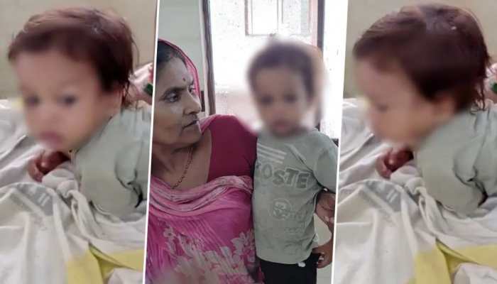 Bihar Toddler Bites Cobra To Death, Doctor Explains Why He Survived