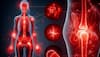 Does Inflammation Cause Social Deprivation And Heart Disease Risk? Shocking Study Reveals