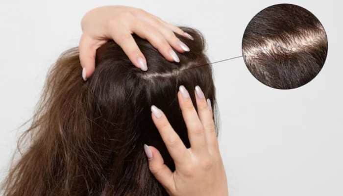 Your Scalp Needs Skincare Too: Ingredients That Transform Hair