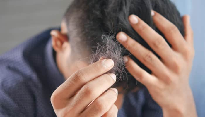 Is Social Media Stress Behind Rising Hair Loss In Teens? Experts Reveals