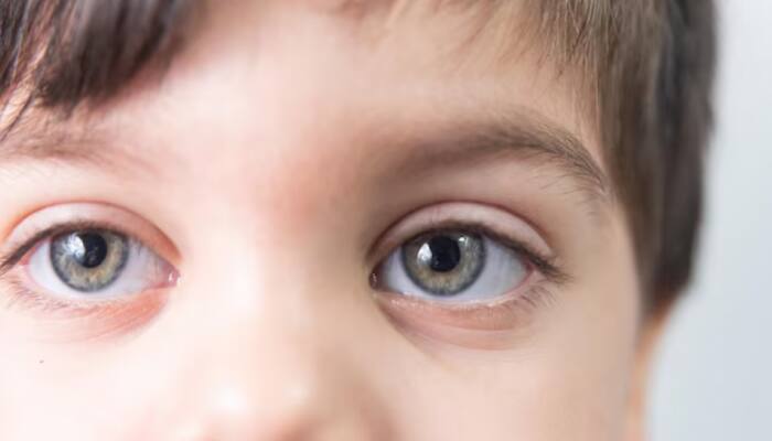 Study Reveals Omega-3 Fatty Acid-Rich Diet May Boost Eye Health In Kids
