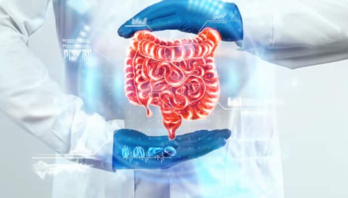 8 Early Warning Signs Of Colon Cancer You Should Never Ignore: From Constipation, Diarrohea To Hidden Symptoms