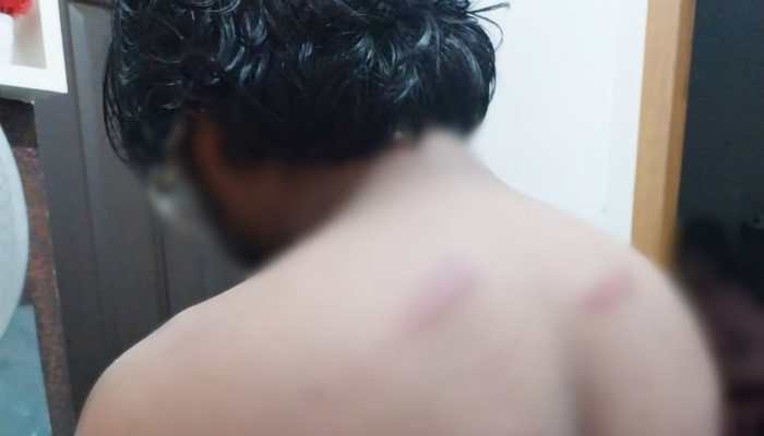 Kerala Shocking: Man Alleges Police Harassment Against His Son