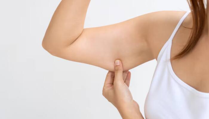 How To Tighten And Prevent Saggy Skin Post Weight Loss With Simple Lifestyle Hacks And Skincare Tips