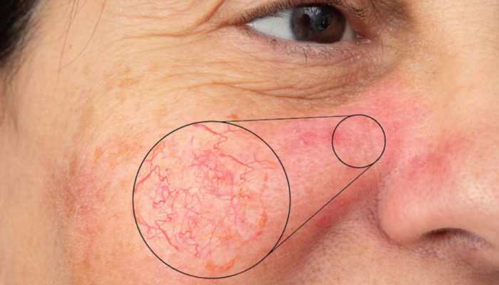 How Climate Change Is Quietly Damaging Your Skin? 