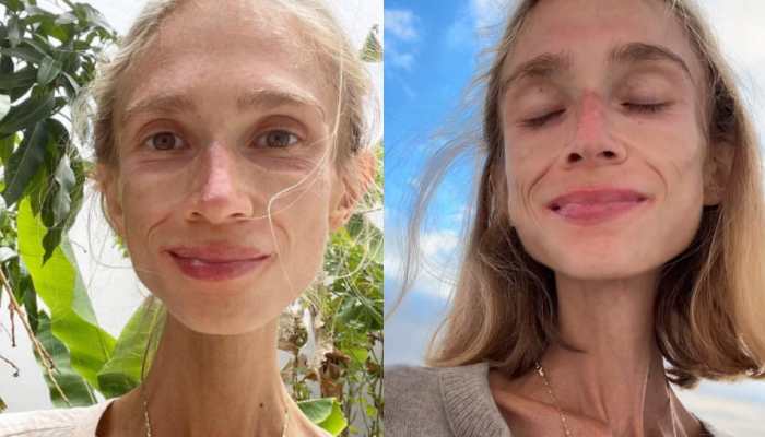 The Fruit Trap: How A 'Wellness' Trend Led A Young Woman To A Tragic, Preventable Death