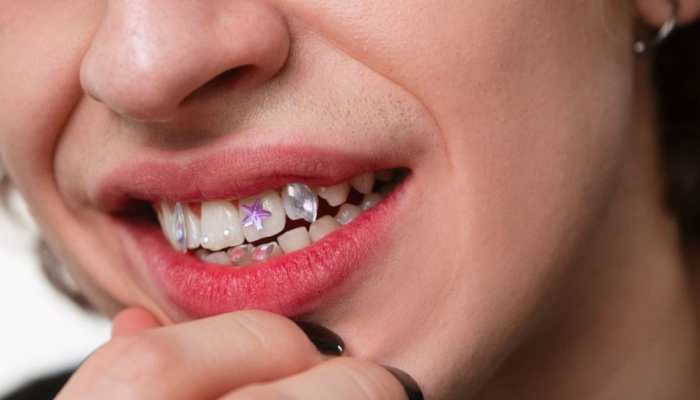 Would You Try It? Viral ‘Tooth Tattoos’ Trend In China Raises Eyebrows, Netizens React As It Sparks Debate On Dental Health