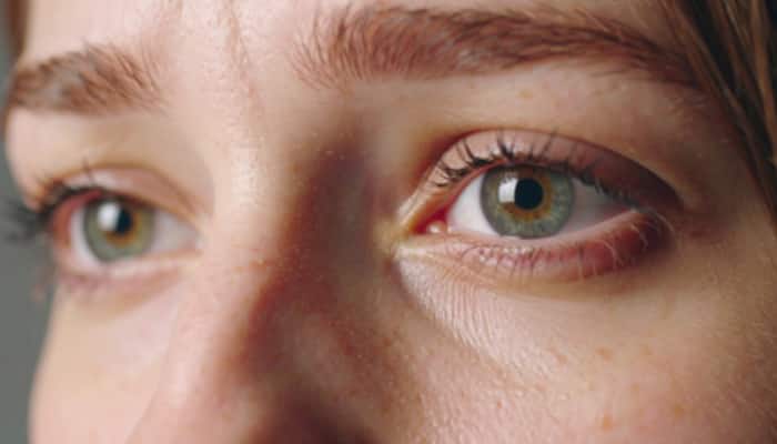Nearly 1 Bn People Are Living With Avoidable Vision Loss: Report