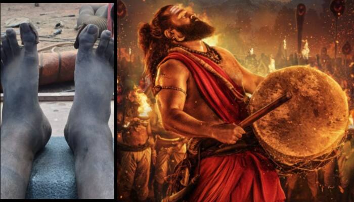 Rishab Shetty Injured During ‘Kantara: Chapter 1’, Reveals Shooting Climax With Swollen Leg