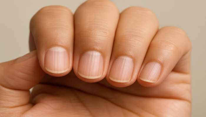 Nail Lines You’re Ignoring Could Be Life-Altering: Here’s What Your Body Is Missing