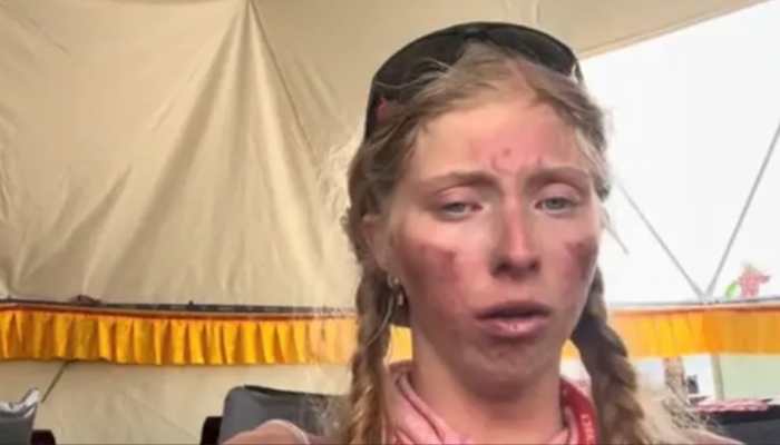Chilling Viral Video: Australian Teen Climber Reveals Body's Toll After 3 Days In Everest 'Death Zone'