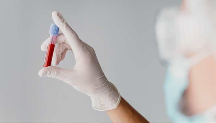Jharkhand Horror: Five Thalassemia Children Test HIV-Positive After Suspected Contaminated Blood