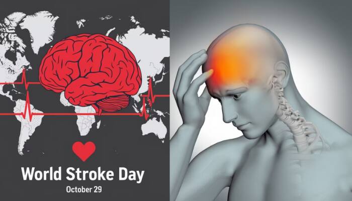 World Stroke Day 2025: Experts Reveal Early Warning Signs You Should Never Ignore