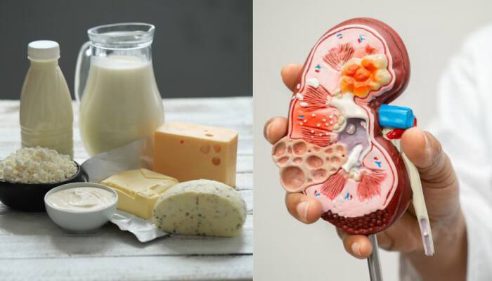 Is Your Daily Diet Secretly Harming Your Kidneys? 5 Foods You Should Stop Eating Now