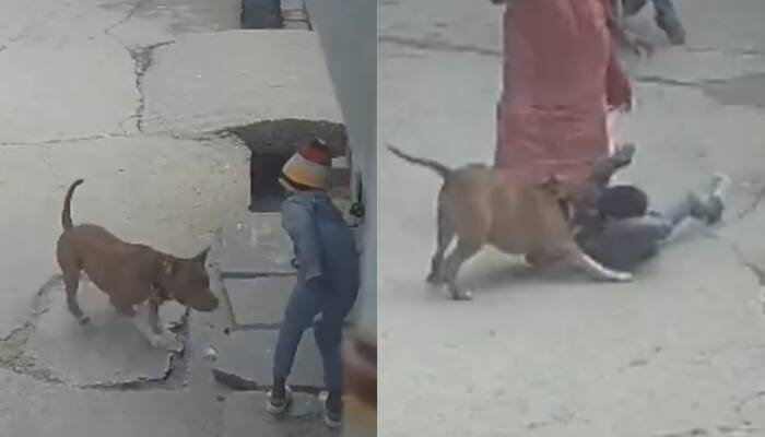 Delhi: 6-Year-Old Boy Attacked By Pitbull, Ear Torn Off, Teeth Broken