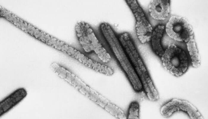 Ethiopia Faces A Deadly Marburg Virus Outbreak: How This Killer Disease Spreads &amp; Why Africa’s Health Crisis Is Worsening