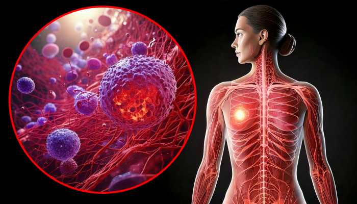 Night Shifts And Frequent Flying May Raise Risk Of Aggressive Breast Cancer In Women: Study Warns