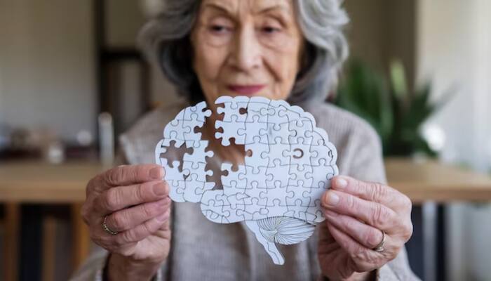 Scientists Say Alzheimer’s May Not Be Permanent After All, This New Study Is Giving Families Real Hope