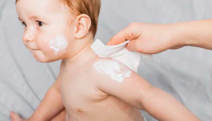 Baby Lotion Or Baby Cream? Here’s What Neonatologists Recommend